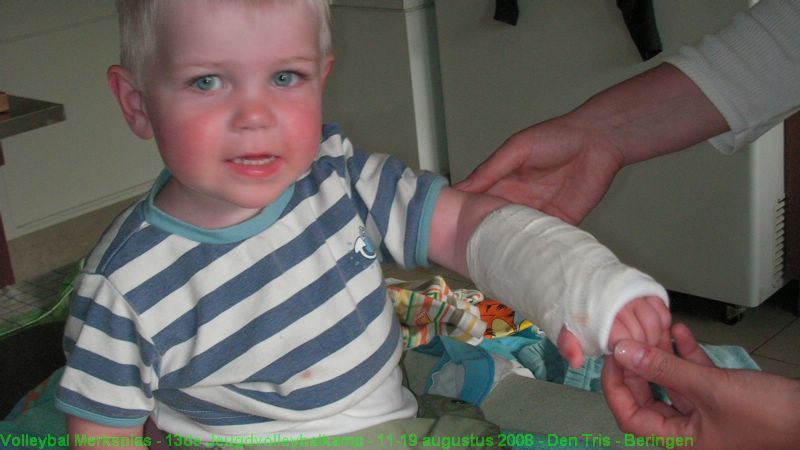 Lander in de gips.